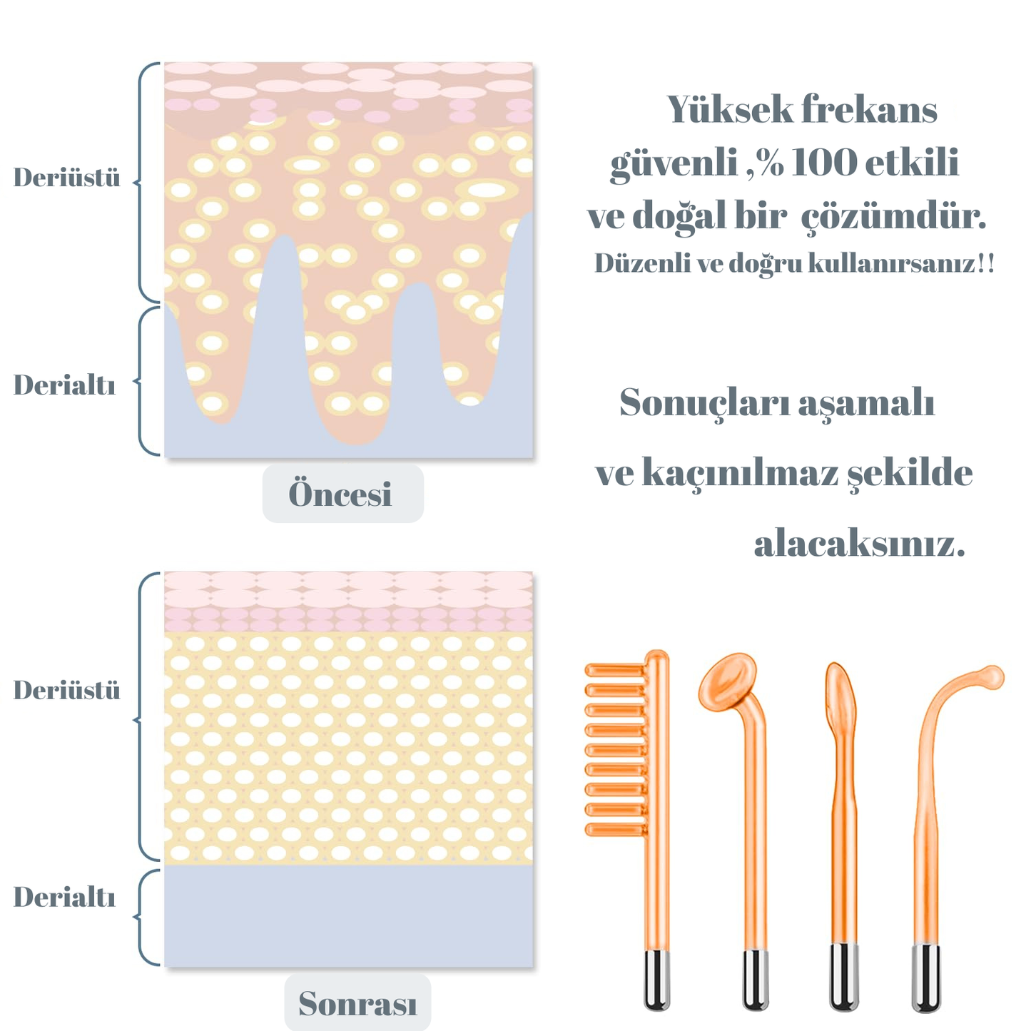 Yüksek Frekans Cilt Bakım Cihazı