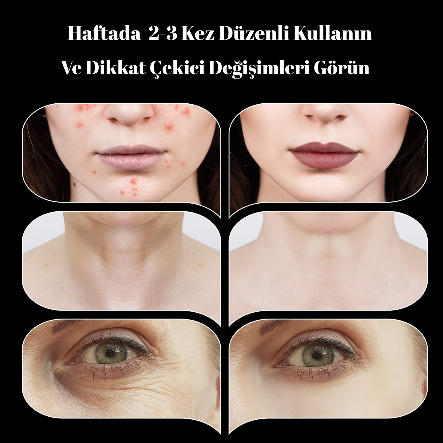 Yüksek Frekans Cilt Bakım Cihazı